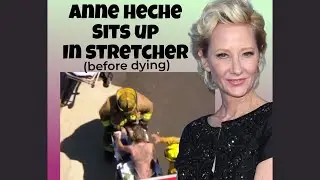 VIDEO Actress Anne Heche Sits Up In Stretcher After Being Pulled From Flames, She Later Dies