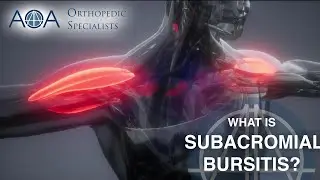 AOA Orthopedic Specialists - Subacromial Bursitis