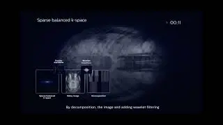 MRI - Compressed Sense- How does it work!!