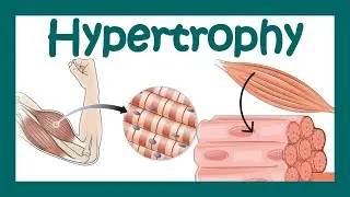 Hypertrophy | What is hypertrophy? | Mechanism of muscle hypertrophy | How does hypertrophy happen?