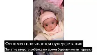 История Ребекки. Женщина забеременела будучи беременной. Её дети – редкие в мире близнецы