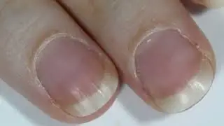 Как убрать кутикулу в домашних условиях