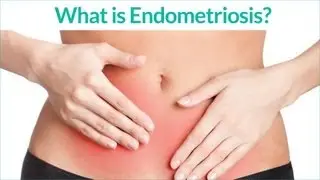 What is Endometriosis and what are the Endometriosis Symptoms ?