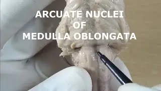 ARCUATE NUCLEI