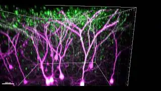 2-D images of nerve cells in the brain of a live mouse