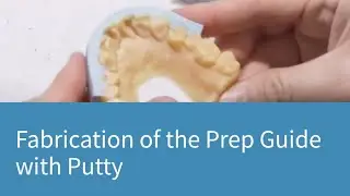 Fabrication of the Prep Guide with Putty