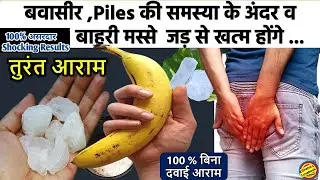 बवासीर (Piles) को 5 दिन में जड़ से खत्म करें-Piles Treatment in hindi-Bawasir ka ilaj #pilestreatment