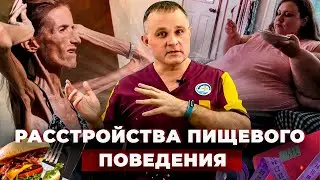 РАССТРОЙСТВА ПИЩЕВОГО ПОВЕДЕНИЯ: симптомы и лечение | Анорексия, булимия, орторексия: в чем причина?