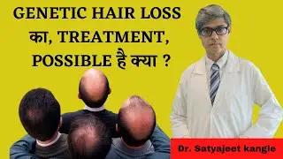 Genetic Hair Loss Treatment - Dr. Satyajeet Kangle