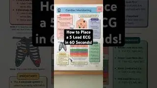 🔥 How to Place a 5 Lead ECG in 60 Seconds! [Electrode Telemetry Cardiac Monitor]