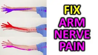 3 Exercise To Relieve Arm Pain, Numbness, Pins and Needles