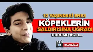 Ankara Pursaklar'da köpek saldırısı- durumu ağır