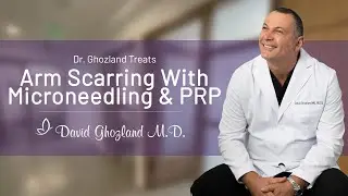 Dr. David Ghozland Treats Arm Scarring With Microneedling & PRP