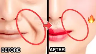 8mins SMILE LINES Facial Exercises (Nasolabial Folds) Lift Smile Wrinkles with this WORKOUT!