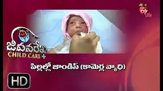 Jeevanarekha child care | Jaundice in Children | 3rd May 2018 | జీవనరేఖ చైల్డ్ కేర్