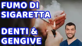 Effetti e Danni del Fumo di Sigaretta su Denti e Gengive