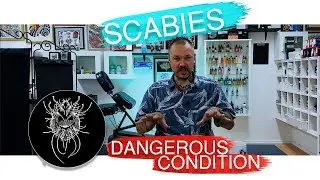 Tattoo Shop Stories - Bugs Under Skin (scabies)