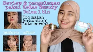 Review Sabun & Gold Jelly Kedas Beauty |#Mikazayn