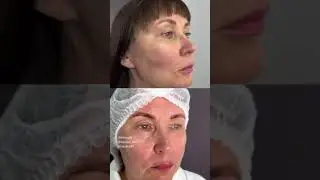 Моложе на 10 лет. Вторая молодость. Пластический хирург Круглик С.В.