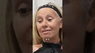 Her facial rejuvenation brings her to happy tears! 💕