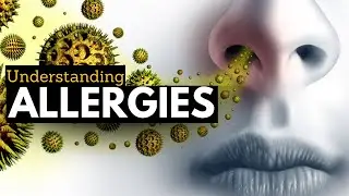 What is Allergy? Causes, Signs and Symptoms, Diagnosis and Treatment.