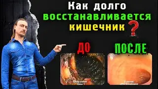 Как восстановить кишечник и микрофлору? Сколько времени это займёт?