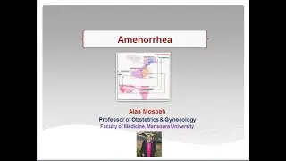 Amenorrhea