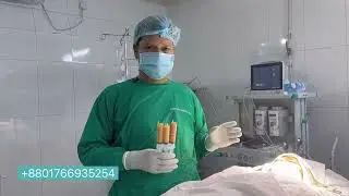 Fat transfer to face | চর্বি দিয়ে গাল ভরাট করা | Dr Iqbal Ahmed plastic surgery | Fat transfer