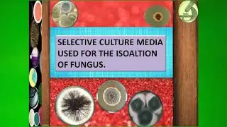 Culture Media Used For The Isolation Of Fungus