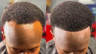 HOW TO FIX A BALDING RECEDING HAIRLINE | PERFECT HAIRCUT FIX