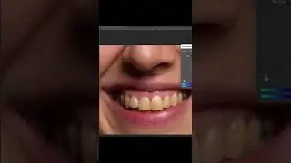 How to make teeth white in 