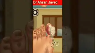 3D Animation of First aid of ToeNail wound. 