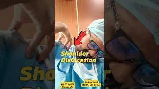 बार-बार कंधा उतरता है🔥 Shoulder Dislocation 💥