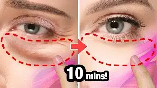 10mins!! Anti-Aging Face Exercises For Eye Bags, Eye Wrinkles, Dark Circles Under Eyes | No Surgery!