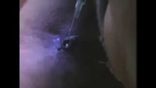IV drug use
