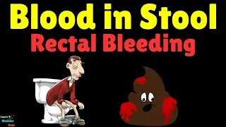 Blood in Stool – Causes, Symptoms, Diagnosis, Treatment & Prevention | Rectal Bleeding