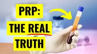 Platelet Rich Plasma (PRP) Injections: Everything You Need to Know