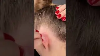 Приклеивал уши к голове??