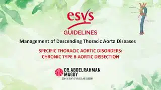 Guidelines In Lines Management of DTA Diseases: Chronic Type B Aortic Dissection