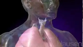 COPD Animation