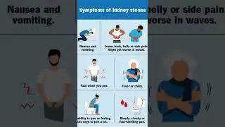 Symptoms of kidney stones #nephrology #kidneystone #viralshorts #stomachpain #urologycare #nausea