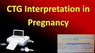 Interpretation of Cardiotocography for Assessment of Fetal Wellbeing, NICE Guideline