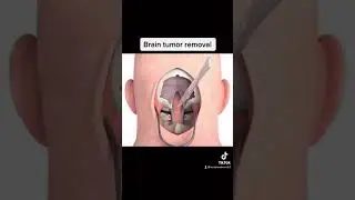 How things actually work😳 