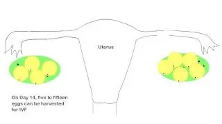 Controlled Ovarian hyperstimulation