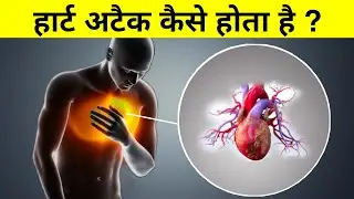 हार्ट अटैक कैसे होता है ? heart attack science