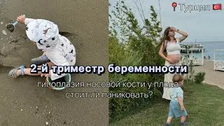 2-й триместр беременности. Гипоплазия носовой кости. Как проходили первые роды. Наш отпуск в Турции