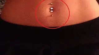 why does my belly button hurt when i touch it