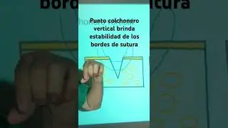 El punto colchonero vertical en cirugia #ciencia #cirugiarefractiva #educacion #cirugiacapilar