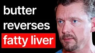 The FASTEST Way To Fix Fatty Liver Naturally (10 COMMON Symptoms) Dr Ken Berry